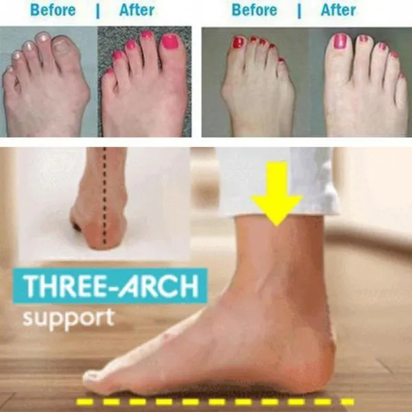 BESTWALK™ Orthopedic Premium Toe Corrector Bunion Comfy Foot Sandals